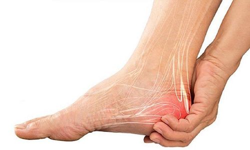 Viêm gân gót chân Achilles có thể do nhiều nguyên nhân khác nhau gây ra