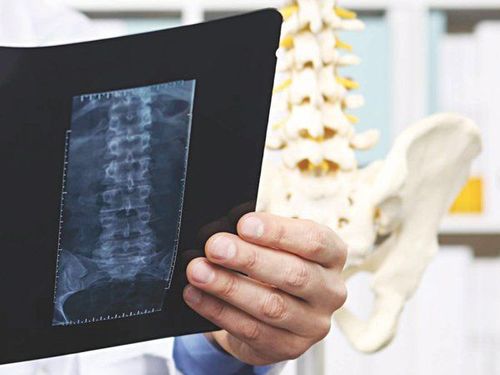 
Giải đáp gãy xương chậu có mang thai được không?
