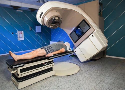 Xạ trị ung thư phổi giai đoạn di căn não