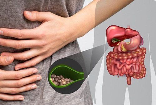The presence of gallstones is a cause of gallbladder fistula.