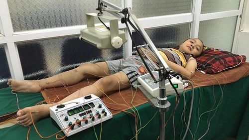 Phục hồi chức năng cho trẻ bị loạn dưỡng cơ Duchene