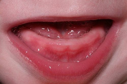 Baby teeth can take a long time to grow, depending on each child's constitution.