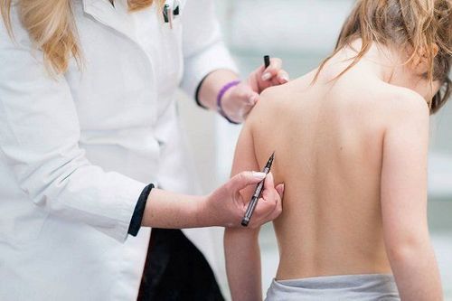 Trẻ 13 tuổi cơ thể phát không đều phải làm sao?