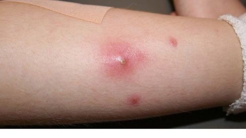 Cây xạ đen chữa bệnh gì?