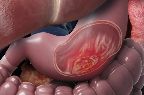 Dạ dày cơ thể chúng ta và những điều cần biết
