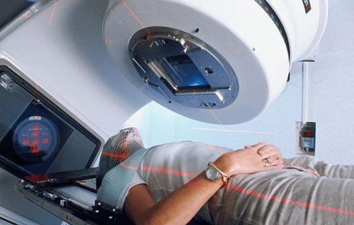 Xạ trị có thể là nguyên nhân gây bệnh ung thư phổi