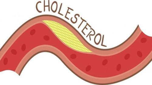 Chỉ số cholesterol tăng nhẹ nên làm gì?