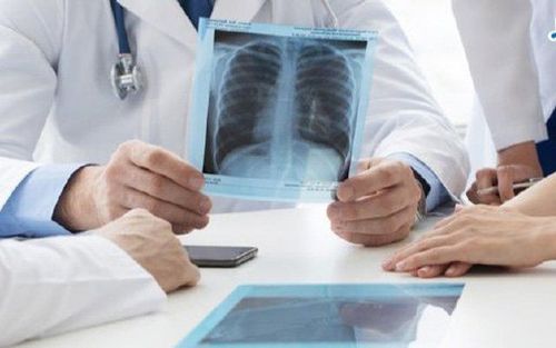Giải đáp ung thư phổi sống được bao lâu?