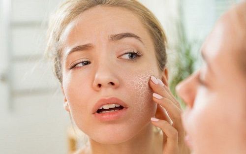 Khô da, đỏ da, ban đỏ, tróc da là các tác dụng phụ có thể gặp phải khi sử dụng thuốc Azaduo