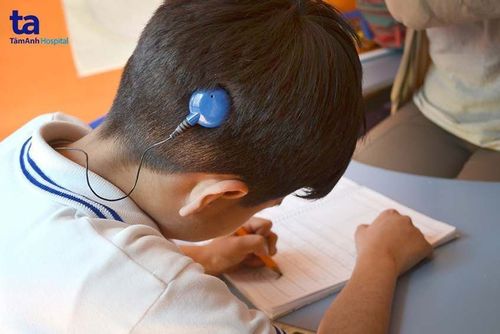 Cấy ốc tai điện tử có nguy hiểm không? Ưu và nhược điểm