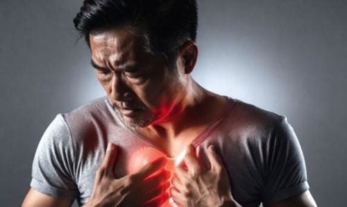 Đau tim là nguyên nhân dẫn đến nguy cơ ngừng tim đột ngột