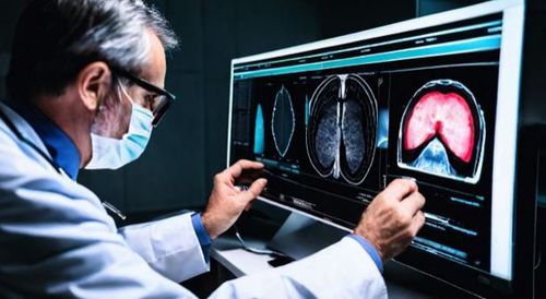 Các thiết bị hỗ trợ tim mạch cũ cần được giám sát cẩn thận trong quá trình chụp MRI