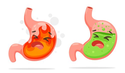 Nên khám trào ngược dạ dày ở đâu? Các yếu tố cần cân nhắc 