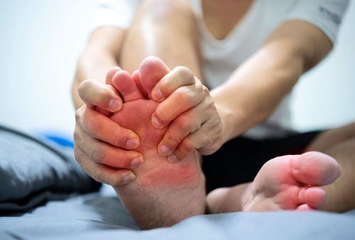 Acute Gout: Symptoms and Quick Pain Relief
