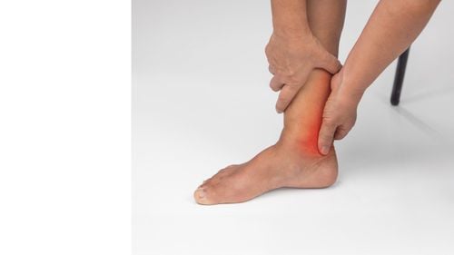 Ankle Sprain and Its Treatment