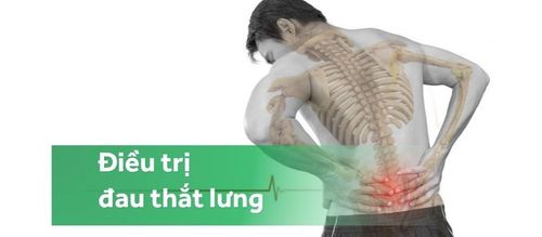 Điều trị đau thắt lưng do cong cột sống mãi không khỏi phải làm gì?