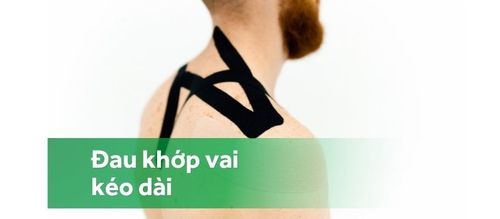 Đau khớp vai là dấu hiệu bệnh gì?