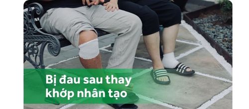 Slide item