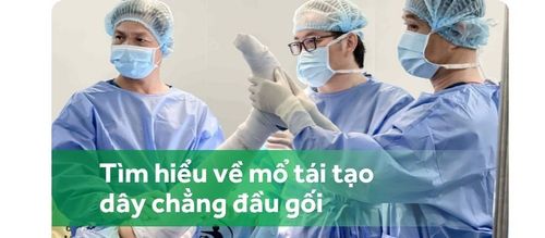 Mổ tái tạo dây chằng đầu gối hết bao nhiêu? Khi mổ có phải gây tê hay gây mê không?