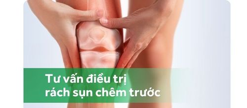 Dập dây chằng chéo trước, rách sụn chêm trước có cần mổ không?