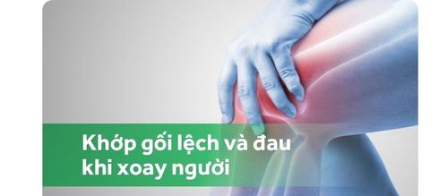 Khớp gối lệch và đau khi xoay người do đứt dây chằng chéo trước khớp gối 4 năm có nên mổ không?