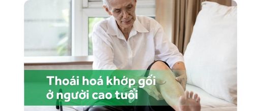 Thoái hóa khớp gối: Nỗi ám ảnh của người cao tuổi