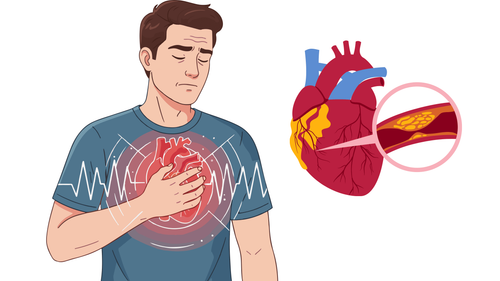 Đau tức ngực là dấu hiệu bệnh gì?