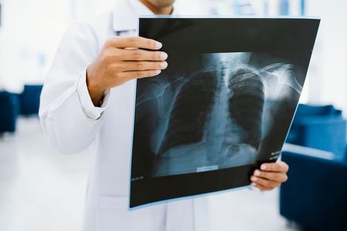 An X-ray should be ordered before treating a fractured rib