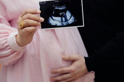 Shear-wave elastography