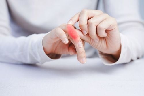 Finger swelling should be examined by a physician to be properly diagnosed