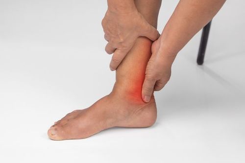 Gout symptoms typically cause pain and swelling in the initial phase.