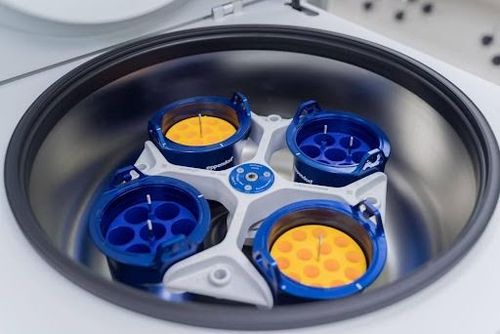 Kết quả xét nghiệm sẽ ảnh hưởng đến quá trình điều trị sau ghép thận của bệnh nhân.