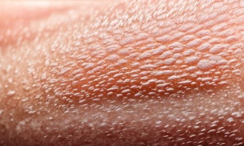Dị ứng có lây không và những thông tin quan trọng về dị ứng