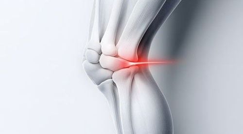Rheumatoid arthritis can cause cracking sounds in the joint