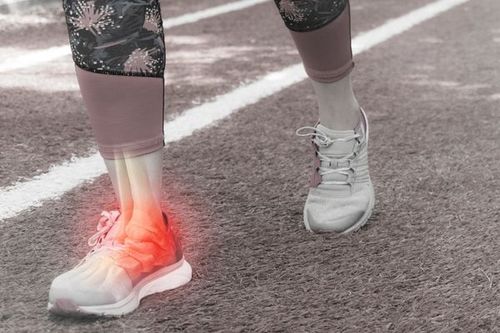 Injuries can cause ankle joint pain without swelling.