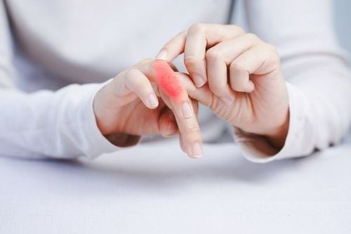 Tingling sensation in the fingers is a non specific sign of carpal tunnel syndrome