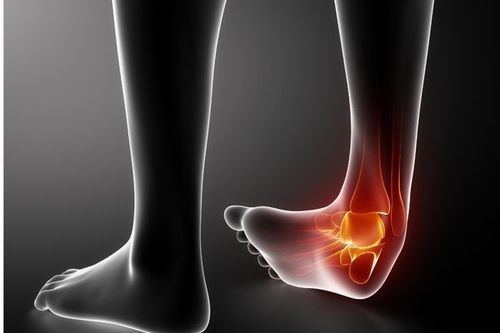Ankle dislocation causes difficulty with movement for patients