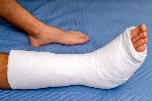 Fixation hardware removal after orthopedic trauma surgery is a relatively common procedure.