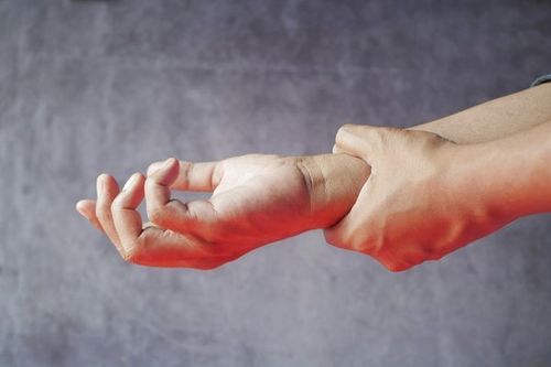 A compressed nerve causes carpal tunnel syndrome