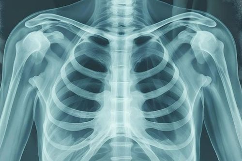 X-ray has limited value in diagnosing tumors of the sternum and below the sternum
