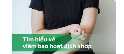 Viêm bao hoạt dịch khớp: Những điều cần biết