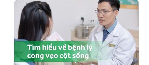Trắc nghiệm: Bạn biết gì về bệnh vẹo cột sống?