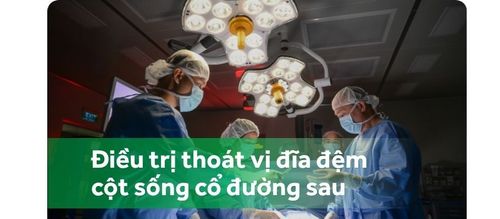 Phẫu thuật nội soi lấy thoát vị đĩa đệm cột sống cổ đường sau