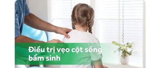Chẩn đoán và điều trị cong vẹo cột sống bẩm sinh