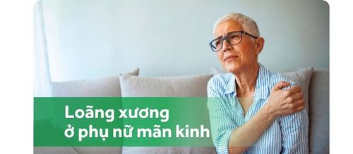 Dự phòng loãng xương ở phụ nữ mãn kinh