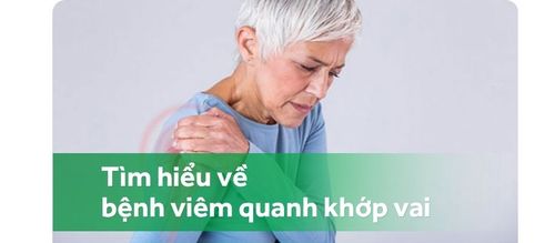 Bệnh viêm quanh khớp vai có tự khỏi được không?