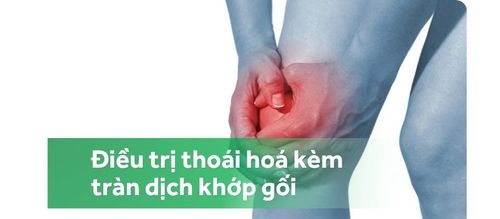 Điều trị thoái hóa khớp gối kèm tràn dịch khớp gối thế nào?