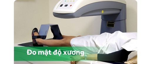 Đo mật độ xương phát hiện kịp thời tình trạng loãng xương