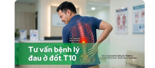 Bị đau ở đốt t10 là bệnh gì?