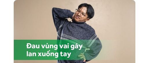 Đau vùng vai gáy lan xuống tay- dấu hiệu thoát vị đĩa đệm cột sống cổ?